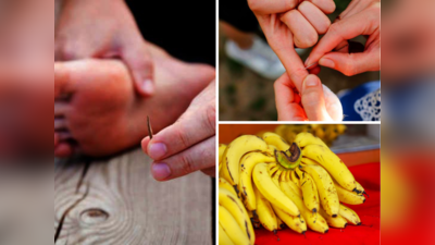 How to Remove a Splinter: कांटा लगा हाय लगा...फिक्र न करें, बिना दर्द छोटा कांटा-फांस निकालेंगी 5 चीजें