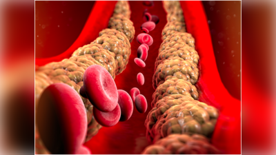 Cholesterol: ಕೊಲೆಸ್ಟ್ರಾಲ್‌ಗೆ ಆಯುರ್ವೇದ ಚಿಕಿತ್ಸೆ ಏನು?