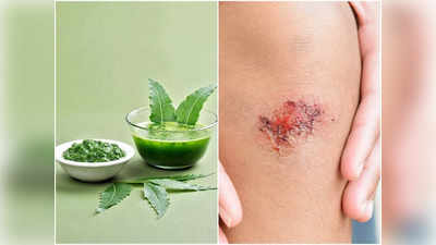 Benefits of Neem Leaves: নিমপাতা খেলেই বশ মানে বহু অসুখ, এর গুণে মশগুল চিকিৎসাবিজ্ঞানও