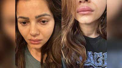Rubina Dilaik Face: रुबीना दिलैक की तबीयत खराब, चेहरा का हुआ बुरा हाल, लोग बोले- आप तो राखी सावंत जैसी लग रही