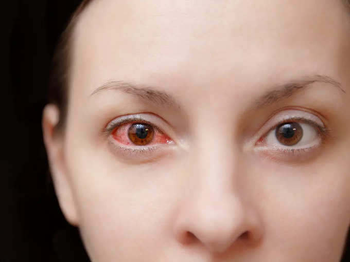 क्या है आंख का ये घातक कैंसर?