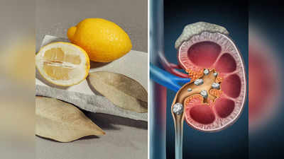 How To Remove Kidney Stones: ওষুধ-অস্ত্রোপচার নয়, কিডনির পাথর গলিয়ে দেবে এই ফল, চিকিৎসকের থেকে জেনে নিন খাওয়ার পদ্ধতি