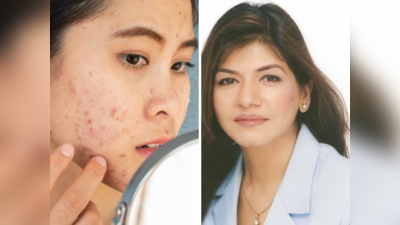 रक्त होईल स्वच्छ आणि चेहरा चमकू लागेल,डॉक्टरांनी सांगितला चमकदार त्वचा मिळविण्याचा सोपा मार्ग