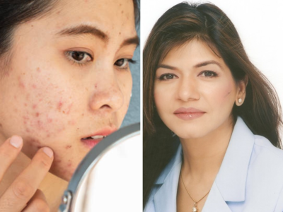 रक्त होईल स्वच्छ आणि चेहरा चमकू लागेल,डॉक्टरांनी सांगितला चमकदार त्वचा मिळविण्याचा सोपा मार्ग