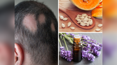 Alopecia Areata Home Remedies: इस बीमारी में गुच्छों में झड़ते हैं बाल, वैज्ञानिकों के 8 उपाय फिर से उगा देंगे