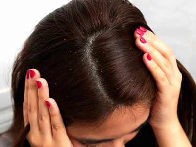 Anti Dandruff Serum: बालों से डैंड्रफ को कम करते हैं ये सीरम, पाएं स्मूद और शाइनी हेयर
