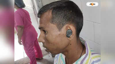 Bardhaman News : রক্ত বন্ধ করতে কানে এমসিল আঠা! দেখে তাজ্জব চিকিৎসকরা, তারপর...