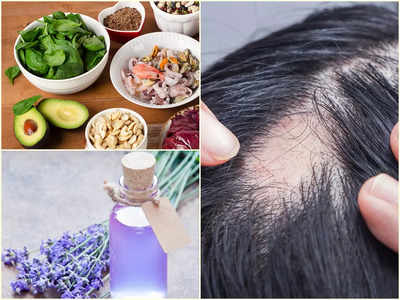 Hair Loss Home Remedies: এই অসুখে গোছা গোছা চুল উঠে টাক পড়ে! বিশেষজ্ঞদের ৩ টোটকায় ফিরে পান মাথা ভর্তি ঘন চুল