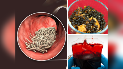 पेट नहीं, आंतों में चिपकते हैं कीड़े, चूस लेंगे खून का कतरा-कतरा, AIIMS डॉ. ने बताए 6 भयंकर लक्षण