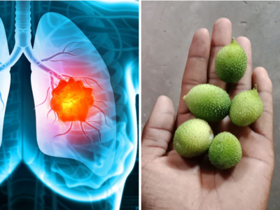 How to Prevent Lung Cancer: धीरे-धीरे फेफड़ों को गला देती हैं ये 3 चीजें, कैंसर से बचा लेंगे Dr. के 5 उपाय