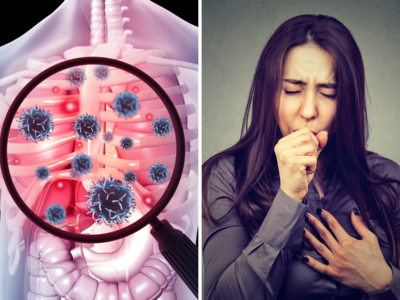 TB Cough Symptoms: ज्याला तुम्ही सामान्य खोकला समजत आहात तो TB तर नाही ना? या 8 लक्षणांवरून झटक्यात ओळखा फरक.!