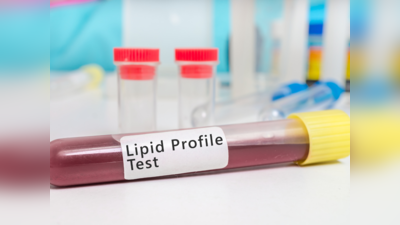 Lipid Profile Test: ಕೊಲೆಸ್ಟ್ರಾಲ್ ಇರುವವರು ಲಿಪಿಡ್ ಪ್ರೊಫೈಲ್ ಪರೀಕ್ಷೆ ಮಾಡಿಸುವುದು ಯಾಕೆ ಮುಖ್ಯ ಗೊತ್ತಾ?