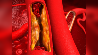 How to Reduce LDL Cholesterol : கெட்ட கொழுப்பை கரைத்து வெளியேற்றும் 5 அற்புத உணவுகள்