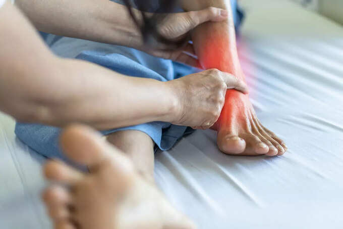 Uric Acid Home Remedies Uric Acid Home Remedies