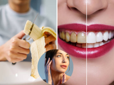 Skin Care : केळ्याचे साल फेकून देताय? थांबा!  चेहऱ्यावर येईल ग्लो व दातही होतील चमकदार