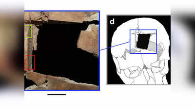 Archaeology News: 3500 साल पुरानी इंसानी खोपड़ी में चौकोर छेद का रहस्य सुलझा, कारण जान पुरातत्वविद भी दंग