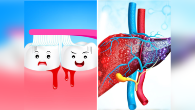 Fatty Liver Disease Symptoms: ब्रश के समय दांतों से आता है खून? फैटी लीवर के इन 13 लक्षणों को न करें नजरअंदाज