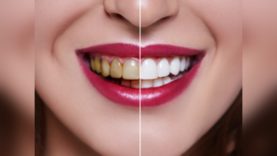 Ayurvedic Remedies for White Teeth:पीले दांतों को सफेद करेंगे Ayurveda डॉ. के 5 उपाय, मुंह की बदबू भी होगी दूर