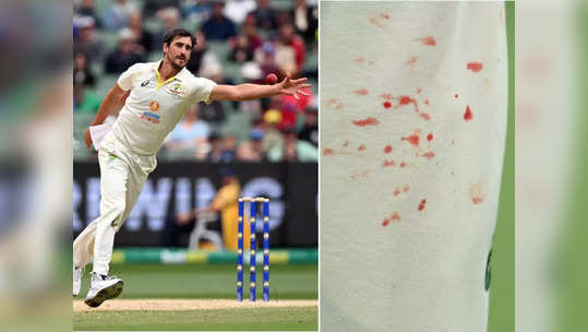 Mitchell Starc Injury | ఇండోర్ టెస్టులో రక్తం కారుతున్నా ఫాస్ట్ బౌలర్ బౌలింగ్.. కమిట్‌మెంట్‌ అంటే ఇదీ! 