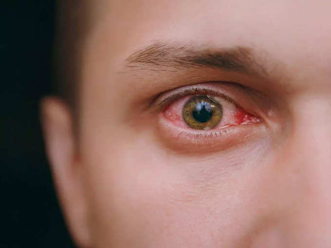 आंखों को डैमेज कर सकते हैं होली के रंग