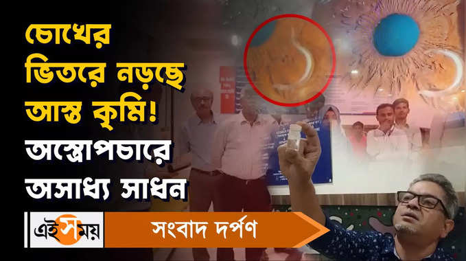 Malda News: চোখের ভিতরে নড়ছে আস্ত কৃমি! অস্ত্রোপচারে অসাধ্য সাধন 