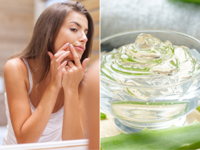 Summer Beauty Tips: ત્વચામાં થતી બળતરાં, ખીલ, પિગમેન્ટેશનને દૂર કરવા એલોવેરામાં મિક્સ કરો આ 1 વસ્તુ, જાણો ફાયદા 