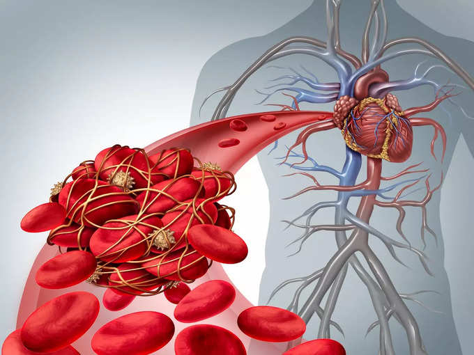 ஹைபர்கால்சீமியா Hypercalcemia என்றால் என்ன?