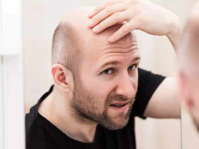 Hair Fall Astro Tips: টাক পড়ছে? পুরুষদের চুল ওঠার জন্য কোন গ্রহ দায়ী, কোন পথে মুক্তি? সব জানুন