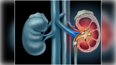 world kidney day:ನುಗ್ಗೆಕಾಯಿ ತಿಂದರೆ ಕಿಡ್ನಿಗಳ ಆರೋಗ್ಯಕ್ಕೆ ಒಳ್ಳೆಯದು!