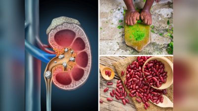 Home Remedies for Kidney Cleansing : किडनी के फिल्टर साफ कर देती हैं ये 10 चीजें, बड़ी से बड़ी पथरी भी आएगी बाहर