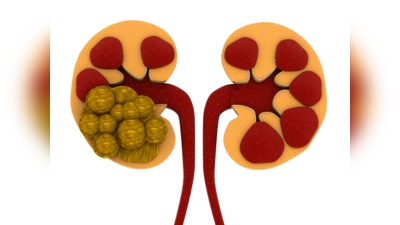 World Kidney Day 2023: சிறுநீரக கல் பிரச்சினை இருக்கா? இந்த 7 ஜூஸ்களை குடிங்க... எப்பேர்ப்பட்ட கல்லும் கரைஞ்சிடும்...