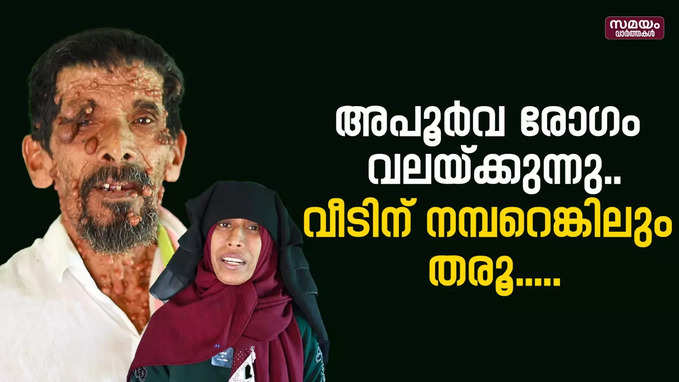 അപൂര്‍വ രോ​ഗം വലയ്ക്കുന്നു..വീടിന് നമ്പറെങ്കിലും തരൂ....