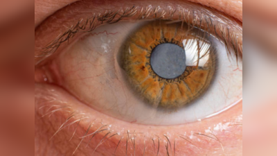 ग्लुकोमा काय आहे, काळ्या मोतीबिंदूमुळे डोळे गमावू शकता का? लक्षणे, कारणे आणि उपाय