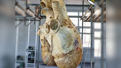 ​OMG! हे आहे जगातलं सर्वात मोठं हृदय, नुसतं वजनच आहे १८१ किलो