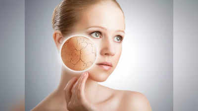 Dry Skin In Summer : வெயிலில் சருமம் வறட்சியாவதை தடுக்க சிம்பிளா இதை செய்யுங்களேன், ஆண்களும் தான்!