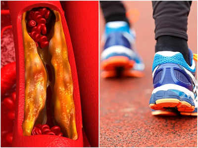 Exercise For Cholesterol: এই ৪ সহজ ব্যায়ামে ওষুধ ছাড়াই কমে কোলেস্টেরল! রোজ মাত্র ৩০ মিনিটেই মিলবে ফল