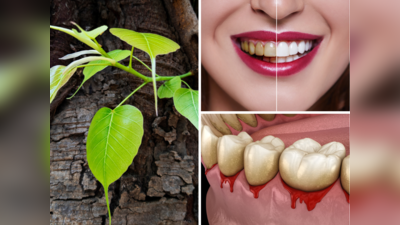 World Oral Health Day: दिखते ही तोड़ लेना 5 जड़ी-बूटी, आयुर्वेद Dr. ने माना दांत होंगे सफेद, मुंह की बदबू होगी दूर