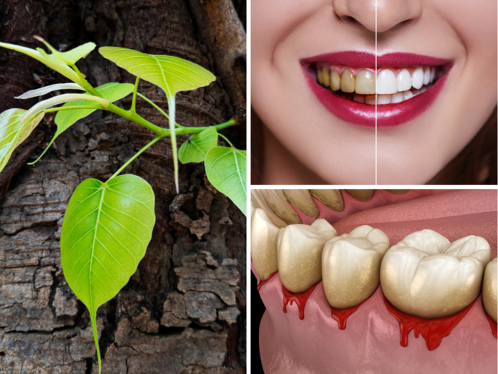on world oral health day ayurveda dr told 5 ayurvedic herbs that can make your yellow teeth white