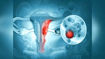 Ovarian Cancer: కొంచెం తిన్నా కడుపు నిండుగా ఉంటుందా..? అండాశయ క్యాన్సర్‌ కావచ్చు..!