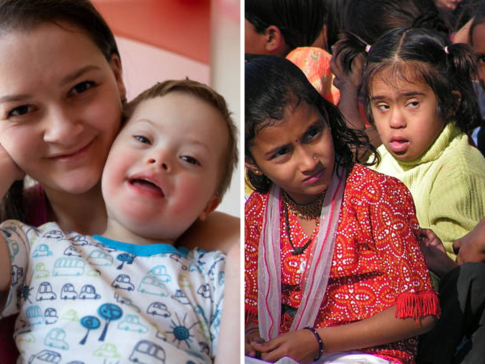 world down syndrome day 2023 know these 5 facts about down syndrome disease