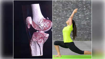 Exercise for Osteoporosis: এই কয়েকটি ব্যায়ামেই হাড়ের ক্ষয় রুখে দেওয়া সম্ভব, অস্টিওপোরোসিস রোগীরা নিয়মিত করলে উপকার পাবেন