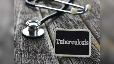 Tuberculosis: टीबी की ये नई दवा सिर्फ दो महीने में कर देगी स्वस्थ, जल्द मरीजों के लिए होगी उपलब्ध