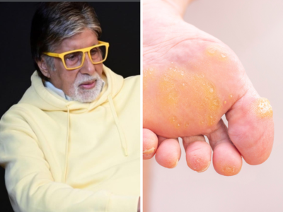 इस कारण हद से ज्यादा दर्द में Amitabh Bachchan, 5 काम करने से होती है ये दिक्कत