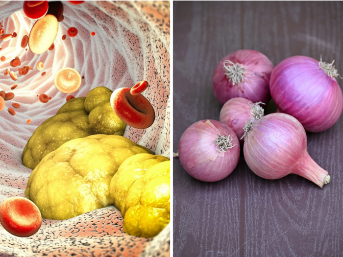chinese scientists reveal onion can reduce bad cholesterol in 8 weeks and increase good cholesterol
