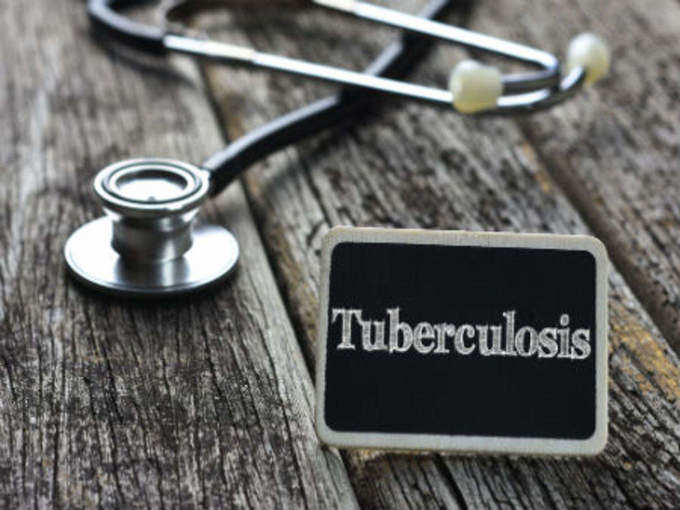 ​டிபி எனும் காசநோய் (tuberculosis)