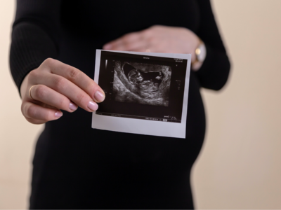 Nuchal Cord : शिशु के गले पर लिपट गई है अम्बिलिकल कॉर्ड, क्‍या बच्‍चे की जान को हो सकता है खतरा?