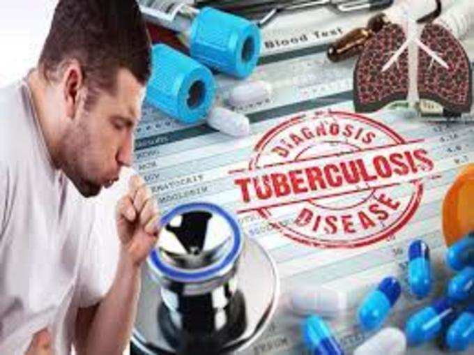 ​காசநோய் தடுப்பு முறை (tuberculosis prevention) 