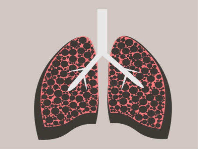 ​காச நோய் என்பது என்ன (what is tuberulosis)