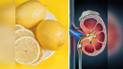 Kidney Stones: কিডনি স্টোন হলেই কি কাটাছেঁড়া করতে হয়?  ঘরোয়া এই প্রতিকার মানলে সমাধান হবে সহজেই