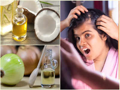 Hair Loss Home Remedies: ২ সপ্তাহেই কমবে চুল পড়া! নারকেল তেল, পেঁয়াজের রস কী ভাবে লাগাতে হবে জেনে নিন